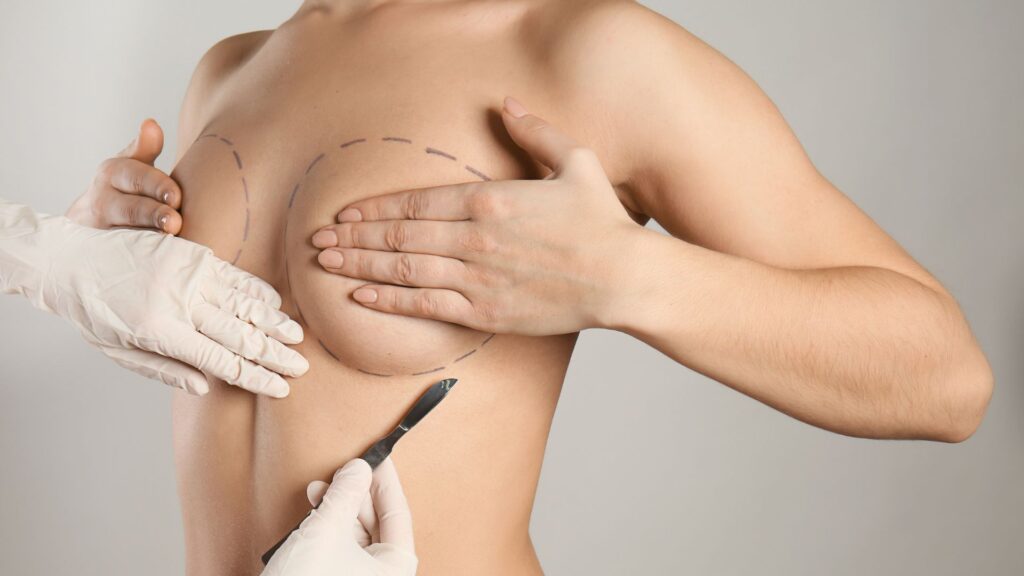 Vor der Brustvergrösserung-Operation