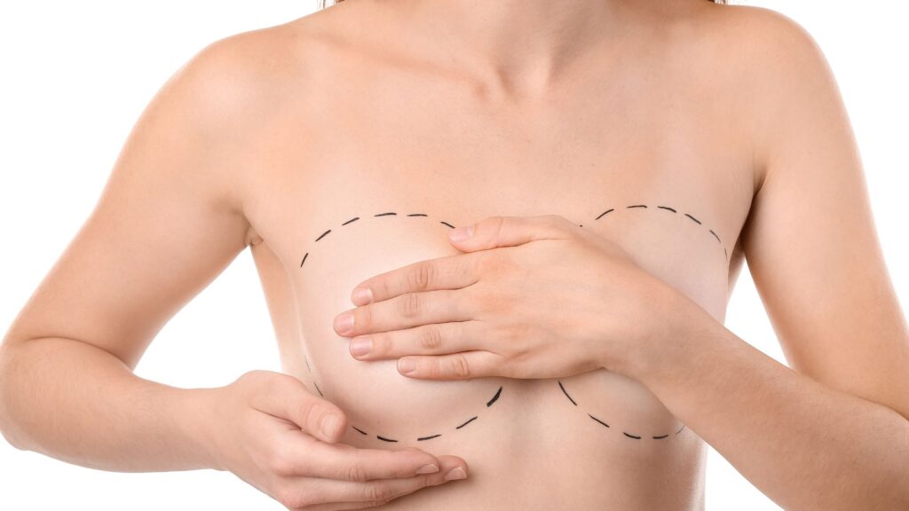 Narben bei der Brustvergrößerung mit Eigenfett