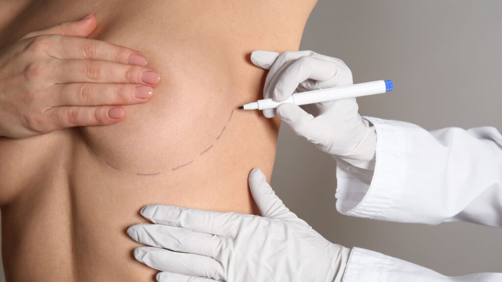 Narben bei der Brustvergrößerung mit Eigenfett vermeiden